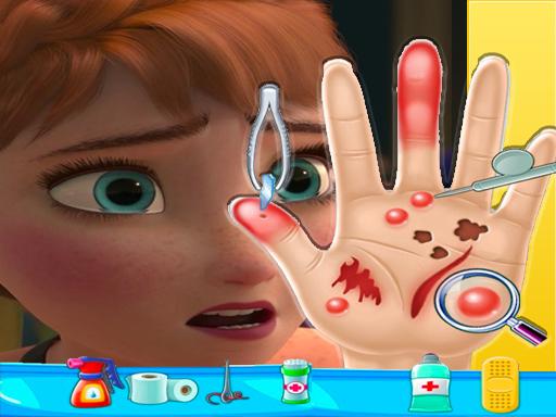 Anna frozen Hand Doctor: Fun Games for Girls Onlin online Girls game