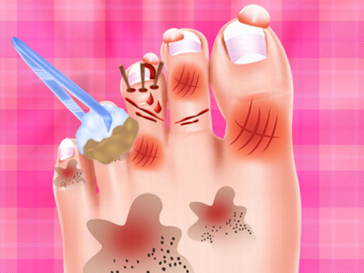 Baby Taylor Foot Treatment online Girls game