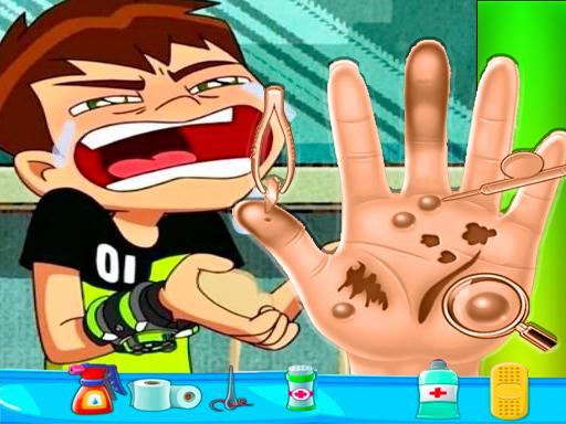 Ben10 Hand Doctor - Free Online Game online game