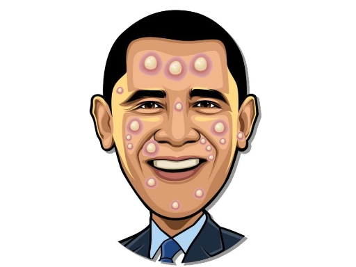 Celebrity Pimple Pop online game