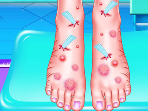 EMMA FOOT TREATMENT online Girls game