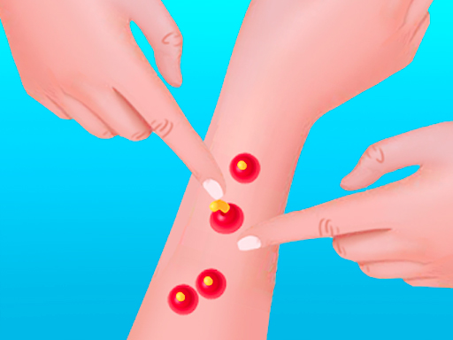 Pimple Poper Rush online game
