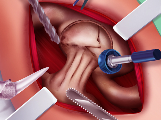 Princess Hips Surgery online game